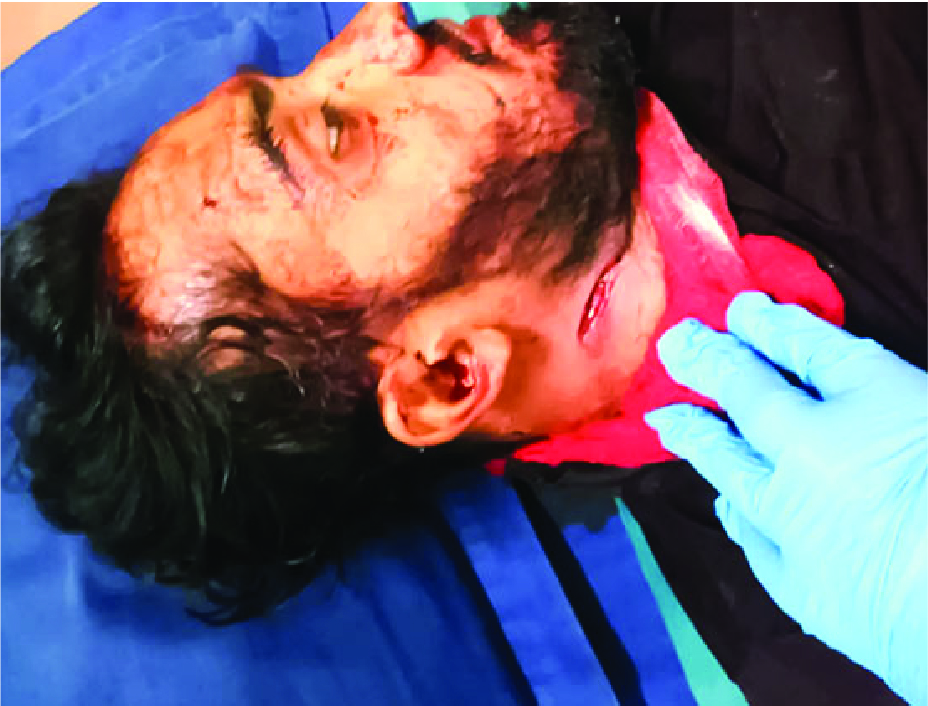 Image of মো: বিপ্লব মণ্ডল